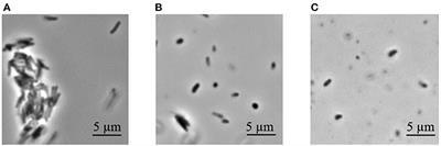 One-Year Old Dormant, “Non-culturable” Mycobacterium tuberculosis Preserves Significantly Diverse Protein Profile